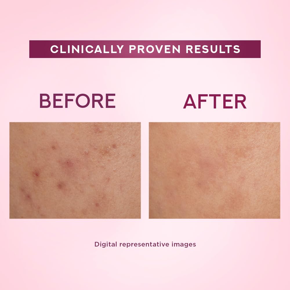 Pond's Bright Beauty Light Cream with UV Filter | Niasorcinol | 100x Better than Vitamin C | Niacinamide | Fades Dark Spots, Brightens Skin, 35g