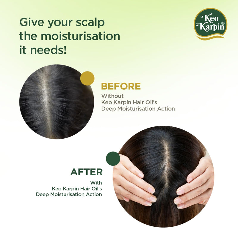 Keo Karpin Hair Oil |Non-Sticky Hair Oil, Enriched With Natural Vitamin E And Olive Oil | 300ml
