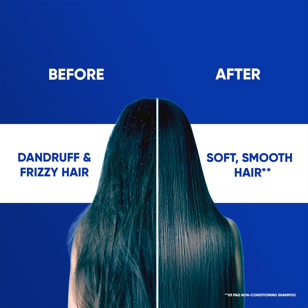 Head & Shoulders , Anti Dandruff Shampoo, Smooth & Silky, 180 ML, White