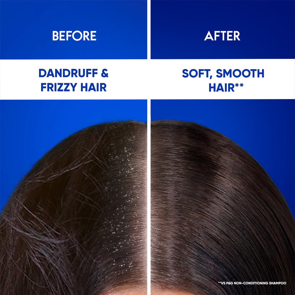 Head & Shoulders Smooth & Silky Anti-Dandruff Shampoo with Free 2-in-1 Conditioner (70 ml) | Up to 100% Dandruff Protection