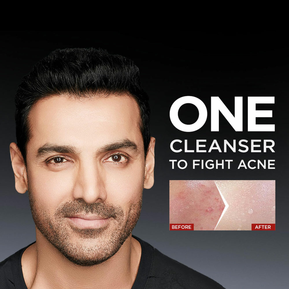 Garnier Men, Anti-Pimple Face Wash, Repairs Skin & Balances Oils, AcnoFight, 150 g